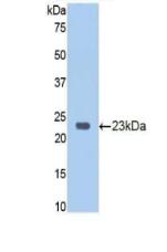 RB1 / Retinoblastoma / RB Antibody - Western Blot; Sample: Recombinant RB1, Human.