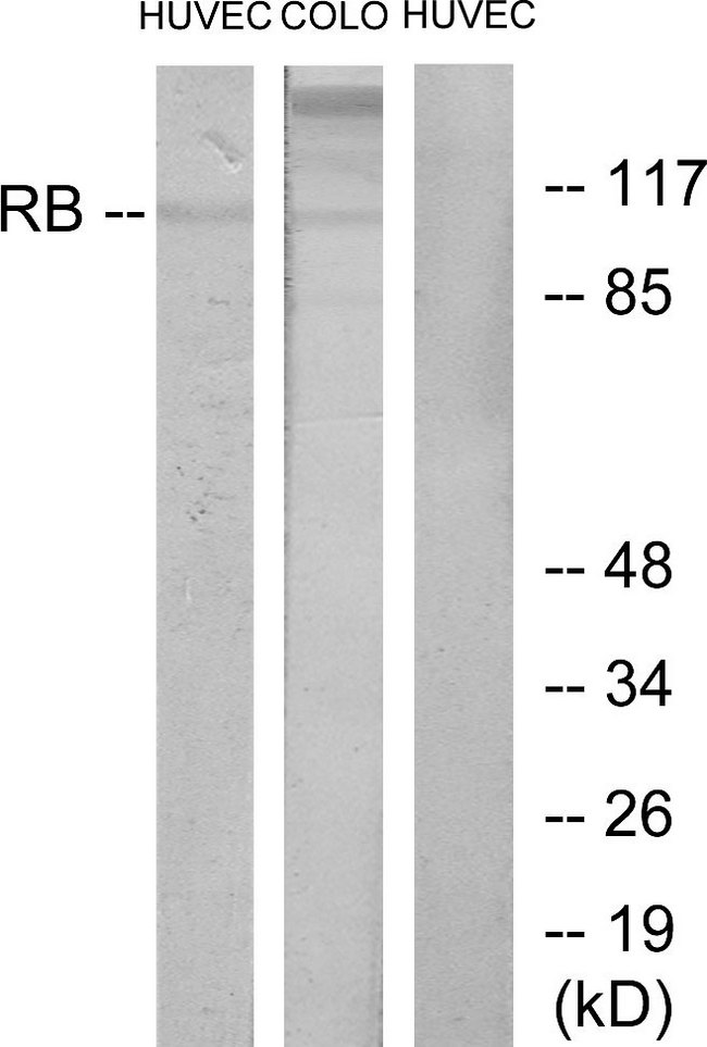 RB1 / Retinoblastoma / RB Antibody - Western blot analysis of lysates from HUVEC and COLO cells, using Retinoblastoma Antibody. The lane on the right is blocked with the synthesized peptide.