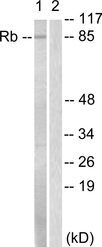 RB1 / Retinoblastoma / RB Antibody - Western blot analysis of lysates from HeLa cells, treated with Calyculin A 50nM 30', using Retinoblastoma Antibody. The lane on the right is blocked with the synthesized peptide.