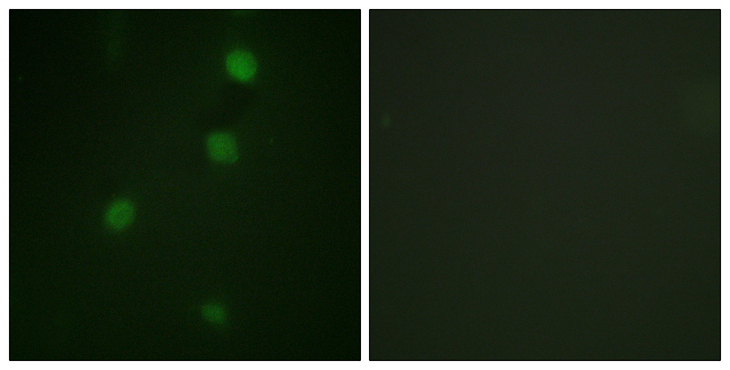RB1 / Retinoblastoma / RB Antibody - Immunofluorescence analysis of NIH/3T3 cells, using Retinoblastoma Antibody. The picture on the right is blocked with the synthesized peptide.