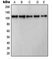 RB1 / Retinoblastoma / RB Antibody - Western blot analysis of RB1 expression in Jurkat (A); COLO205 (B); HUVEC (C); A431 (D); NIH3T3 (E) whole cell lysates.