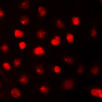 RB1 / Retinoblastoma / RB Antibody - Immunofluorescent analysis of RB1 staining in COLO205 cells. Formalin-fixed cells were permeabilized with 0.1% Triton X-100 in TBS for 5-10 minutes and blocked with 3% BSA-PBS for 30 minutes at room temperature. Cells were probed with the primary antibody in 3% BSA-PBS and incubated overnight at 4 C in a humidified chamber. Cells were washed with PBST and incubated with a DyLight 594-conjugated secondary antibody (red) in PBS at room temperature in the dark. DAPI was used to stain the cell nuclei (blue).