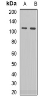 RB1 / Retinoblastoma / RB Antibody - Western blot analysis of RB1 (pS795) expression in HEK293T (A); Jurkat (B) whole cell lysates.