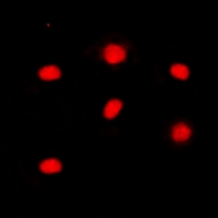 RB1 / Retinoblastoma / RB Antibody - Immunofluorescent analysis of RB1 (pS795) staining in WERI cells. Formalin-fixed cells were permeabilized with 0.1% Triton X-100 in TBS for 5-10 minutes and blocked with 3% BSA-PBS for 30 minutes at room temperature. Cells were probed with the primary antibody in 3% BSA-PBS and incubated overnight at 4 deg C in a humidified chamber. Cells were washed with PBST and incubated with a DyLight 594-conjugated secondary antibody (red) in PBS at room temperature in the dark. DAPI was used to stain the cell nuclei (blue).