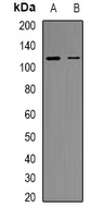 RB1 / Retinoblastoma / RB Antibody - Western blot analysis of RB1 (pS807) expression in HEK293T (A); HUVEC (B) whole cell lysates.