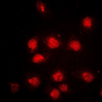 RB1 / Retinoblastoma / RB Antibody - Immunofluorescent analysis of RB1 (pS807) staining in HeLa cells. Formalin-fixed cells were permeabilized with 0.1% Triton X-100 in TBS for 5-10 minutes and blocked with 3% BSA-PBS for 30 minutes at room temperature. Cells were probed with the primary antibody in 3% BSA-PBS and incubated overnight at 4 deg C in a humidified chamber. Cells were washed with PBST and incubated with a DyLight 594-conjugated secondary antibody (red) in PBS at room temperature in the dark. DAPI was used to stain the cell nuclei (blue).
