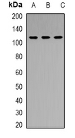 RB1 / Retinoblastoma / RB Antibody - Western blot analysis of RB1 expression in PC3 (A); HeLa (B); NIH3T3 (C) whole cell lysates.