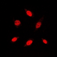 RB1 / Retinoblastoma / RB Antibody - Immunofluorescent analysis of RB1 staining in HUVEC cells. Formalin-fixed cells were permeabilized with 0.1% Triton X-100 in TBS for 5-10 minutes and blocked with 3% BSA-PBS for 30 minutes at room temperature. Cells were probed with the primary antibody in 3% BSA-PBS and incubated overnight at 4 deg C in a humidified chamber. Cells were washed with PBST and incubated with a DyLight 594-conjugated secondary antibody (red) in PBS at room temperature in the dark. DAPI was used to stain the cell nuclei (blue).