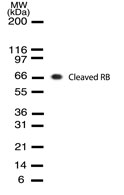 RB1 / Retinoblastoma / RB Antibody - Western blot analysis: HL60 cells were treated with camptothecin for 24 hours.