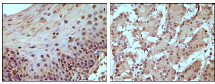 RB1 / Retinoblastoma / RB Antibody - IHC of paraffin-embedded human normal esophagus (A) and stomach (B) tissue, showing nucleus localization using Rb mouse monoclonal antibody with DAB staining.