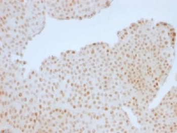 RB1 / Retinoblastoma / RB Antibody - IHC testing of human colon with Rb antibody (clone RB1/1754). Required HIER: boil tissue sections in 10mM citrate buffer, pH 6, for 10-20 min followed by cooling at RT for 20 min.