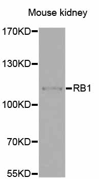 RB1 / Retinoblastoma / RB Antibody - Western blot analysis of extracts of Mouse kidney cells.