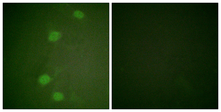 RB1 / Retinoblastoma / RB Antibody - Immunofluorescence analysis of HeLa cells, using Retinoblastoma (Phospho-Ser249) Antibody. The picture on the right is blocked with the phospho peptide.