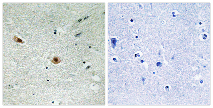 RB1 / Retinoblastoma / RB Antibody - Immunohistochemistry analysis of paraffin-embedded human brain, using Retinoblastoma (Phospho-Ser608) Antibody. The picture on the right is blocked with the phospho peptide.