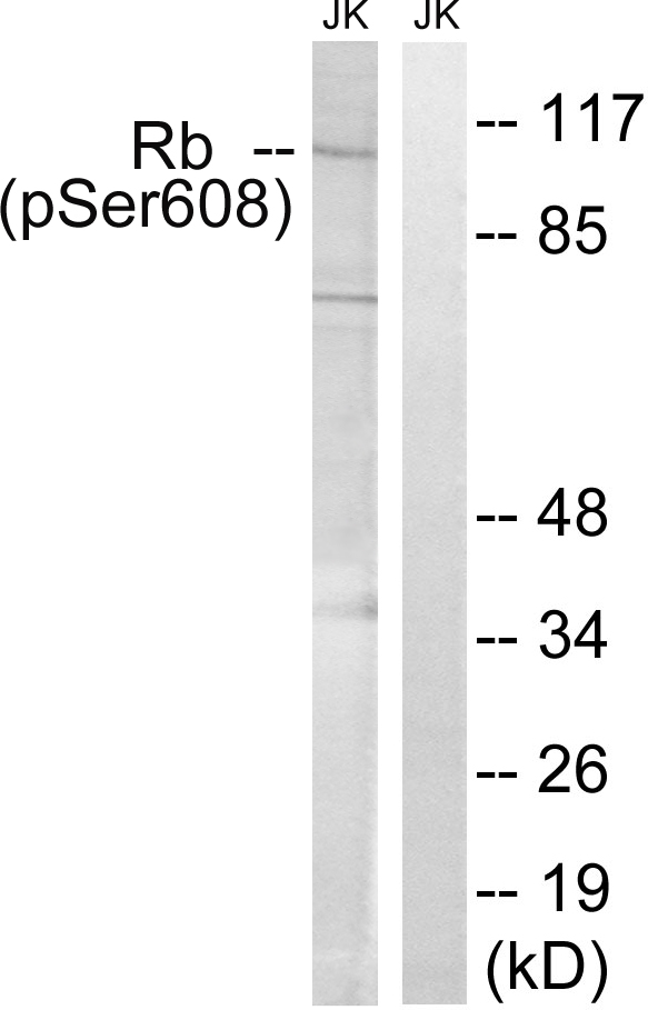 RB1 / Retinoblastoma / RB Antibody - Western blot analysis of lysates from Jurkat cells treated with PMA 125ng/ml 30', using Retinoblastoma (Phospho-Ser608) Antibody. The lane on the right is blocked with the phospho peptide.