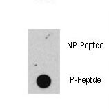 RB1 / Retinoblastoma / RB Antibody - Dot blot of anti-Phospho-RB-S608 Antibody on nitrocellulose membrane. 50ng of Phospho-peptide or Non Phospho-peptide per dot were adsorbed. Antibody working concentrations are 0.5ug per ml.