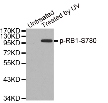 RB1 / Retinoblastoma / RB Antibody - Western blot analysis of extracts from 3T3 cells.