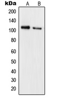 RB1 / Retinoblastoma / RB Antibody - Western blot analysis of RB1 (pS780) expression in Jurkat FBS-treated (A); HeLa (B) whole cell lysates.