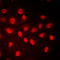 RB1 / Retinoblastoma / RB Antibody - Immunofluorescent analysis of RB1 (pS780) staining in HeLa cells. Formalin-fixed cells were permeabilized with 0.1% Triton X-100 in TBS for 5-10 minutes and blocked with 3% BSA-PBS for 30 minutes at room temperature. Cells were probed with the primary antibody in 3% BSA-PBS and incubated overnight at 4 C in a humidified chamber. Cells were washed with PBST and incubated with a DyLight 594-conjugated secondary antibody (red) in PBS at room temperature in the dark. DAPI was used to stain the cell nuclei (blue).