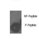 RB1 / Retinoblastoma / RB Antibody - Dot blot of anti-Phospho-Rb-S780 Antibody on nitrocellulose membrane. 50ng of Phospho-peptide or Non Phospho-peptide per dot were adsorbed. Antibody working concentrations are 0.5ug per ml.