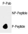 RB1 / Retinoblastoma / RB Antibody - Dot blot of anti-hRb-S788 Phospho-specific antibody on nitrocellulose membrane. 50ng of nonphospho-peptide or phospho-peptide were adsorbed on their respective dots. Antibody working concentration was 0.5ug per ml.
