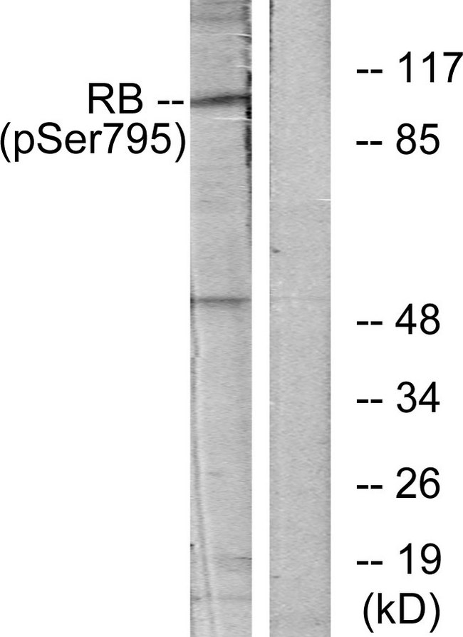 RB1 / Retinoblastoma / RB Antibody - Western blot analysis of lysates from K562 cells treated with serum 10%, using Retinoblastoma (Phospho-Ser795) Antibody. The lane on the right is blocked with the phospho peptide.