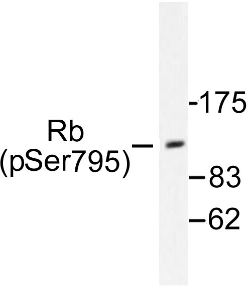 RB1 / Retinoblastoma / RB Antibody - Western blot of p-Rb (S795) pAb in extracts from K562 cells treated with serum 10%.