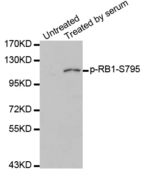 RB1 / Retinoblastoma / RB Antibody - Western blot analysis of extracts of 293 cells.