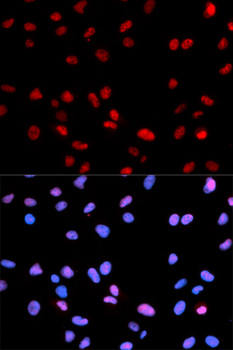 RB1 / Retinoblastoma / RB Antibody - Immunofluorescence analysis of U2OS cells.