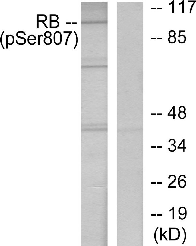 RB1 / Retinoblastoma / RB Antibody - Western blot analysis of lysates from K562 cells treated with serum 10%, using Retinoblastoma (Phospho-Ser807) Antibody. The lane on the right is blocked with the phospho peptide.