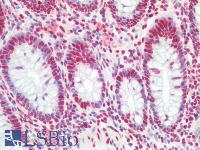 RB1 / Retinoblastoma / RB Antibody - Human Colon: Formalin-Fixed, Paraffin-Embedded (FFPE)