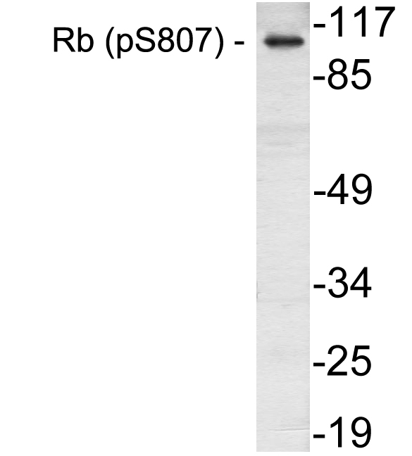 RB1 / Retinoblastoma / RB Antibody - Western blot of p-Rb (S807) pAb in extracts from K562 cells treated with serum 10%.