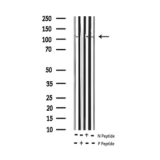 RB1 / Retinoblastoma / RB Antibody - Western blot analysis of Phospho-Retinoblastoma (Ser807) expression in various lysates