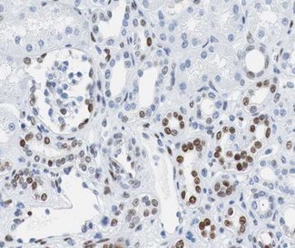 RB1 / Retinoblastoma / RB Antibody - 1:200 staining human kidney tissue by IHC-P. The tissue was formaldehyde fixed and a heat mediated antigen retrieval step in citrate buffer was performed. The tissue was then blocked and incubated with the antibody for 1.5 hours at 22°C. An HRP conjugated goat anti-rabbit antibody was used as the secondary.