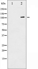 RB1 / Retinoblastoma / RB Antibody - Western blot analysis of Retinoblastoma phosphorylation expression in serum treated K562 whole cells lysates. The lane on the left is treated with the antigen-specific peptide.