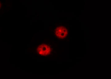 RB1 / Retinoblastoma / RB Antibody - Staining MOLT cells by IF/ICC. The samples were fixed with PFA and permeabilized in 0.1% Triton X-100, then blocked in 10% serum for 45 min at 25°C. The primary antibody was diluted at 1:200 and incubated with the sample for 1 hour at 37°C. An Alexa Fluor 594 conjugated goat anti-rabbit IgG (H+L) Ab, diluted at 1/600, was used as the secondary antibody.