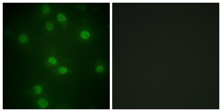 RB1 / Retinoblastoma / RB Antibody - Immunofluorescence analysis of HUVEC cells, using Retinoblastoma (Phospho-Ser811) Antibody. The picture on the right is blocked with the phospho peptide.