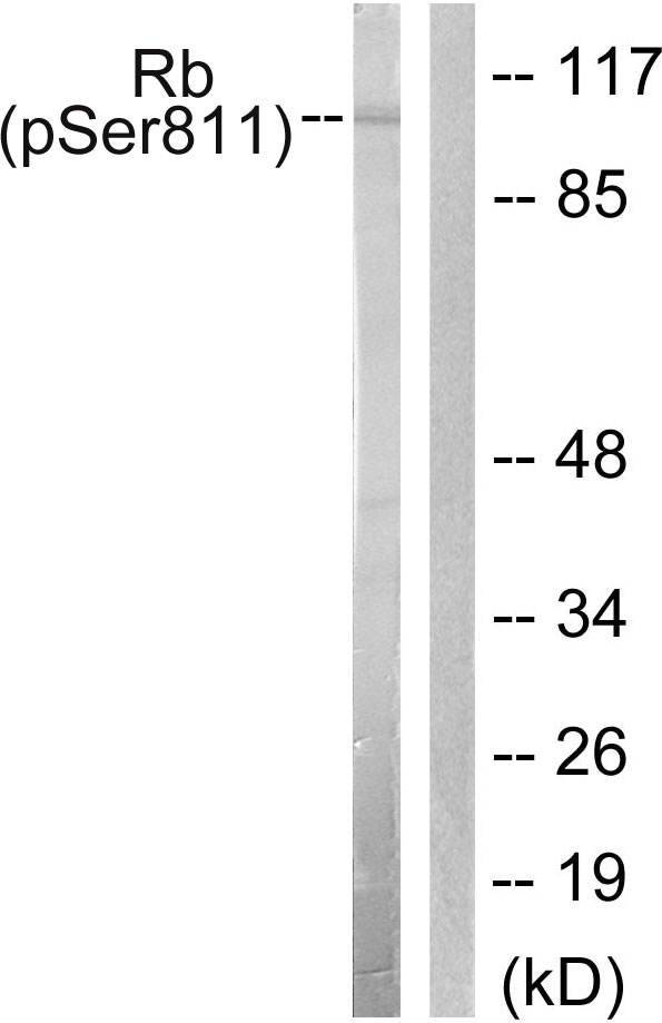 RB1 / Retinoblastoma / RB Antibody - Western blot analysis of lysates from K562 cells, using Retinoblastoma (Phospho-Ser811) Antibody. The lane on the right is blocked with the phospho peptide.