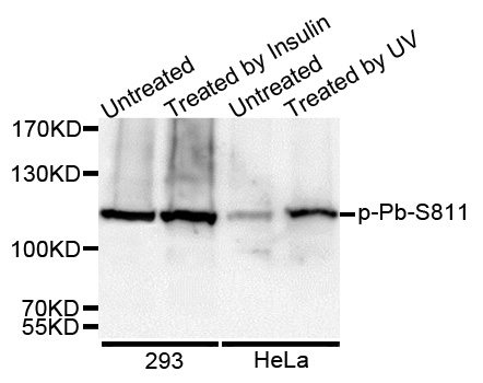 RB1 / Retinoblastoma / RB Antibody - Western blot analysis of extracts of various cell lines.