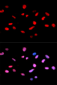 RB1 / Retinoblastoma / RB Antibody - Immunofluorescence analysis of U2OS cells.