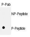 RB1 / Retinoblastoma / RB Antibody - Dot blot of anti-hRb-S811 Phospho-specific antibody on nitrocellulose membrane. 50ng of nonphospho-peptide or phospho-peptide were adsorbed on their respective dots. Antibody working concentration was 0.5ug per ml.