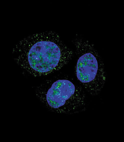 RB1 / Retinoblastoma / RB Antibody - Confocal immunofluorescence of Phospho-Rb-S811 Antibody with HepG2 cell followed by Alexa Fluor 488-conjugated goat anti-rabbit lgG (green). DAPI was used to stain the cell nuclear (blue).