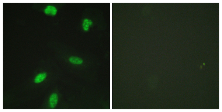 RB1 / Retinoblastoma / RB Antibody - Immunofluorescence analysis of HeLa cells, using Retinoblastoma (Phospho-Thr821) Antibody. The picture on the right is blocked with the phospho peptide.