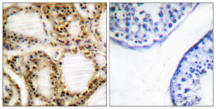 RB1 / Retinoblastoma / RB Antibody - Immunohistochemistry analysis of paraffin-embedded human testis, using Retinoblastoma (Phospho-Thr821) Antibody. The picture on the right is blocked with the phospho peptide.