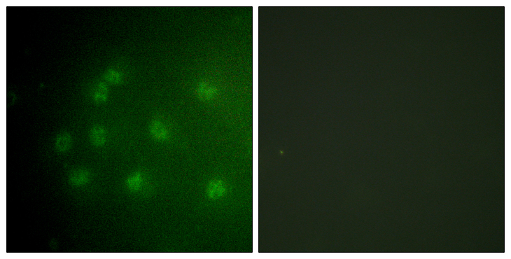 RB1 / Retinoblastoma / RB Antibody - Immunofluorescence analysis of COS7 cells, using Retinoblastoma (Phospho-Thr826) Antibody. The picture on the right is blocked with the phospho peptide.