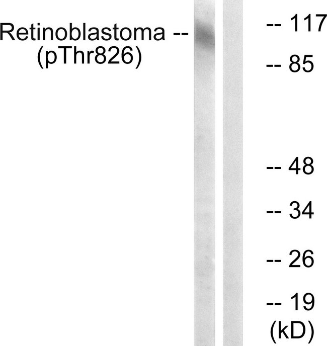 RB1 / Retinoblastoma / RB Antibody - Western blot analysis of lysates from HepG2 cells treated with nocodazole 1ug/ml 16h, using Retinoblastoma (Phospho-Thr826) Antibody. The lane on the right is blocked with the phospho peptide.