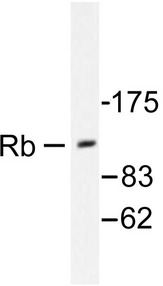 RB1 / Retinoblastoma / RB Antibody - Western blot of Rb (P789) pAb in extracts from MOLT cells.