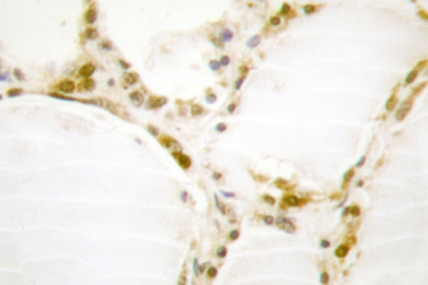 RB1 / Retinoblastoma / RB Antibody - IHC of Rb (S807) pAb in paraffin-embedded human thyroid gland tissue.