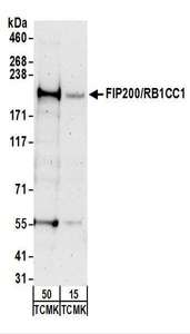 RB1CC1 / CC1 Antibody - Detection of Mouse FIP200/RB1CC1 by Western Blot. Samples: Whole cell lysate from TCMK-1 (15 and 50 ug) cells. Antibodies: Affinity purified rabbit anti-FIP200/RB1CC1 antibody used for WB at 0.2 ug/ml. Detection: Chemiluminescence with an exposure time of 3 minutes.