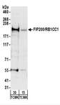 RB1CC1 / CC1 Antibody - Detection of Mouse FIP200/RB1CC1 by Western Blot. Samples: Whole cell lysate from TCMK-1 (15 and 50 ug) cells. Antibodies: Affinity purified rabbit anti-FIP200/RB1CC1 antibody used for WB at 0.2 ug/ml. Detection: Chemiluminescence with an exposure time of 3 minutes.